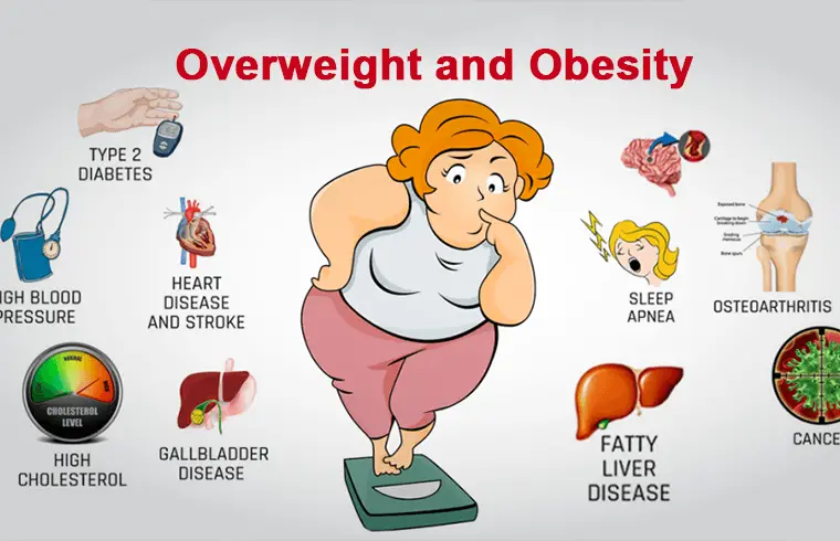 health issues globally : Overweight and Obesity